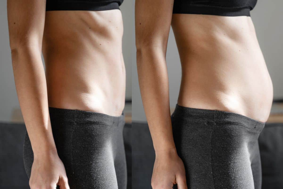 How long does diastasis recti take to improve Chapel House?
