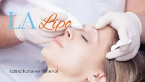 Woman receiving Actinic Keratosis Removal Treatment Chapel House