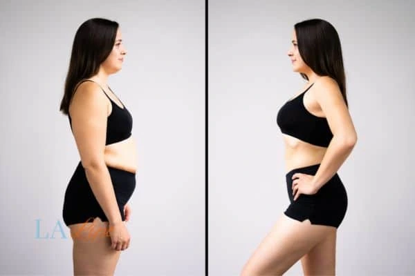 LA-EMS Body Sculpting Chapel House results before and after of womans results on body toning.