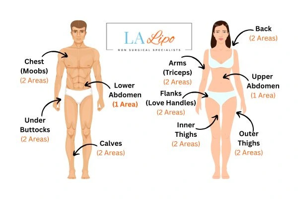 LA LIPO Cryolipolysis Areas Chapel House
