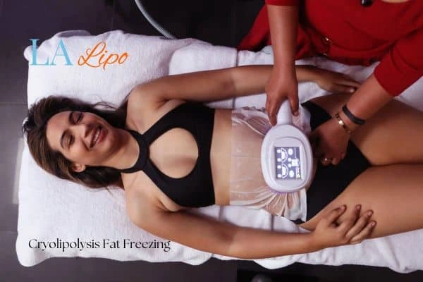 woman getting cryolipolysis Chapel House
