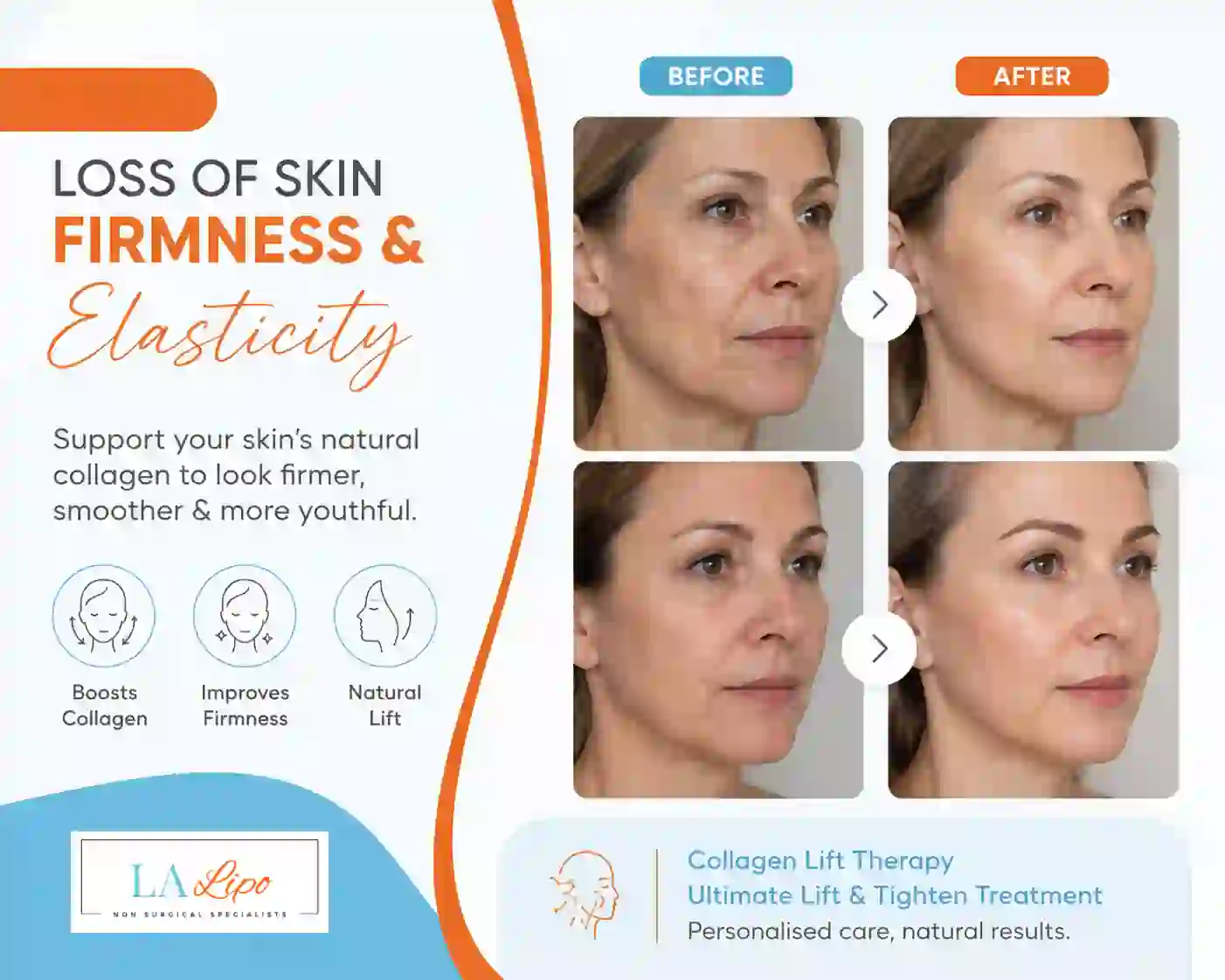 Sign #7: Loss of Skin Firmness and Elasticity Chapel House